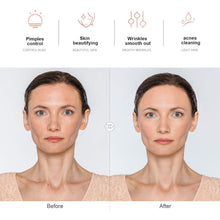 Load image into Gallery viewer, NewWay high-frequency facial machine Wand Argon
